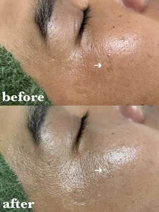 メンズ 肌質改善＆脱毛 【M Mondo】のエステ・リラクイメージ