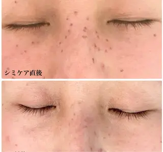 毛穴・シミ専門サロン ルパークのエステ・リラクイメージ