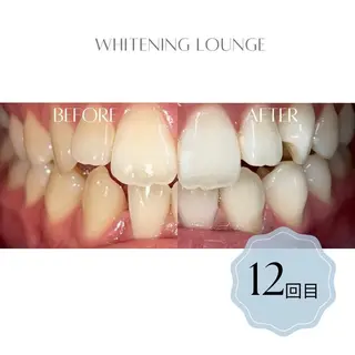 ホワイトニング Lounge横須賀のエステ・リラクイメージ