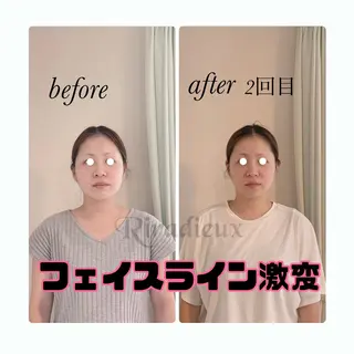 Riradieux ﾘﾗﾃﾞｭ所属・Riradieux 美骨小顔矯正のその他イメージ