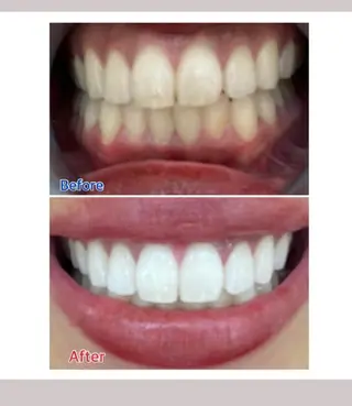 M渋谷 ホワイトニングのエステ・リラクイメージ