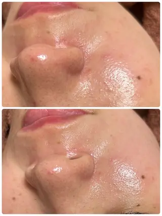 beauty  salon sorelle所属・産毛角質ケア/艶肌 フェイシャルワックスのエステ・リラクイメージ