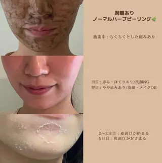 美肌ケアサロン iru【アイル】のエステ・リラクイメージ