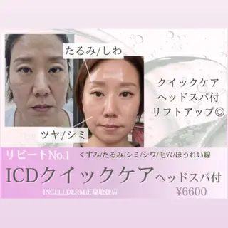 【vidyto】ヴィディトゥ所属・肌管理サロン vidyto　MOEのエステ・リラクイメージ