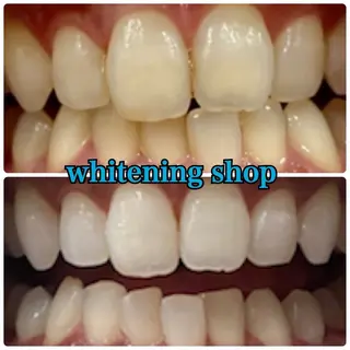 メンズ ホワイトニング ショップ川越店のエステ・リラクイメージ