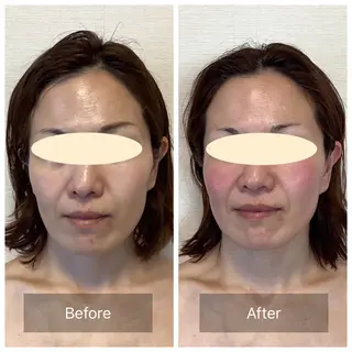 小顔・歪み専門　井元 朋子のエステ・リラクイメージ