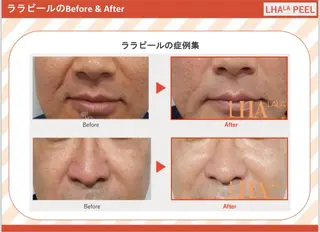 CHOUETTE所属・五島 久美子のエステ・リラクイメージ