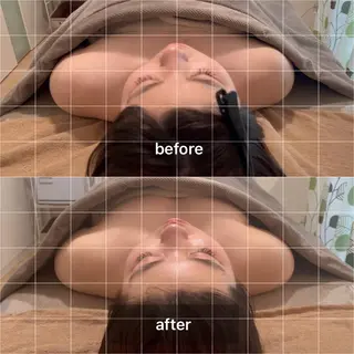 エクラヴィ 小顔・エイジングケアのエステ・リラクイメージ