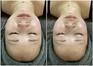 ize 横浜店のエステ・リラクイメージ