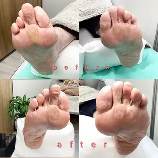 巻き爪補正店 大阪なんば店のネイルデザイン