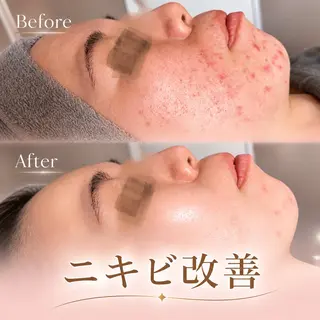 Sui Eye & Beautyのマツエク・マツパデザイン