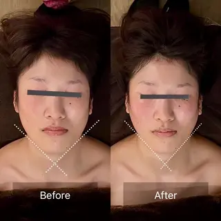 Linoas所属・kogao&head Linoasのエステ・リラクイメージ