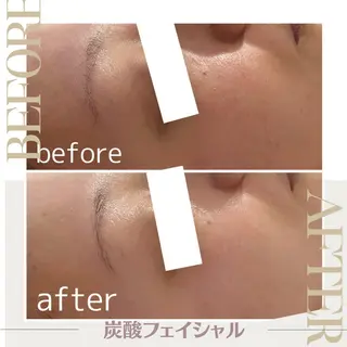 エステサロン シェリーのエステ・リラクイメージ