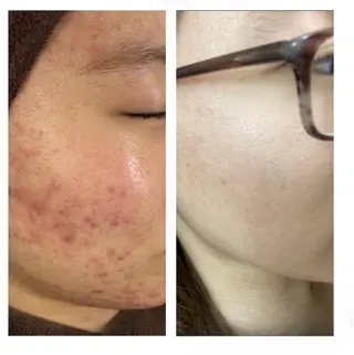 金の糸脱毛 産毛ケア専門のエステ・リラクイメージ