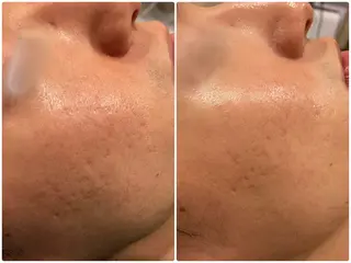 看護師が施術する美容 ナスサロ/星のエステ・リラクイメージ