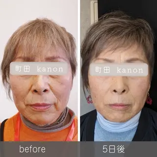 小顔矯正サロン町田 逸見智美のエステ・リラクイメージ