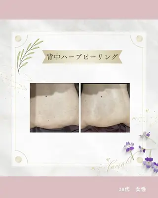 《 肌質×美肌 》 addissimoのエステ・リラクイメージ