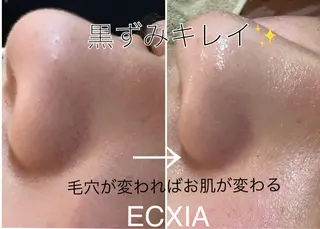 ECXIA 【エクシア】のエステ・リラクイメージ