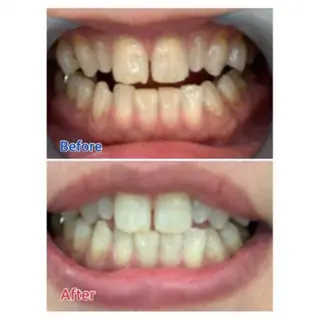 Ｍ渋谷 ホワイトニングのエステ・リラクイメージ