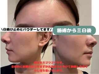 VIKI BEAUTY  クレイハーブピーリング・美肌脱毛専門店所属・VIKI BEAUTYのエステ・リラクイメージ