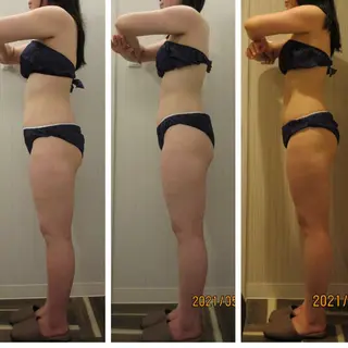 小顔専門店 グレイスボディ三郷店のエステ・リラクイメージ