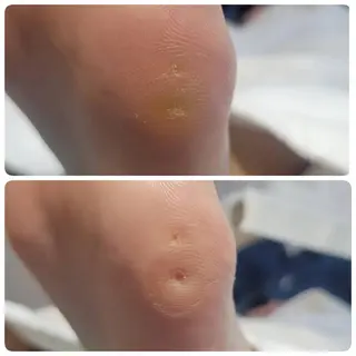 東京巻き爪 アカデミーのエステ・リラクイメージ