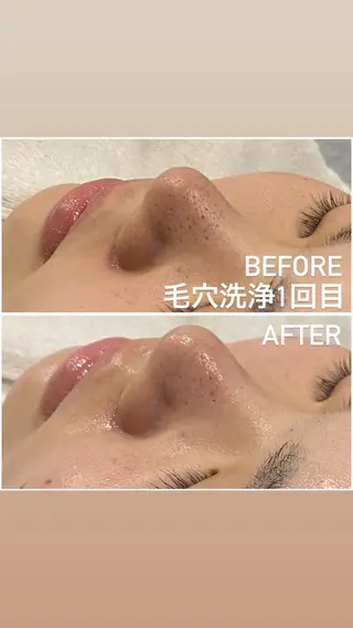 毛穴洗浄・痩身・脱毛 /アルカンジュのエステ・リラクイメージ