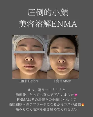 BLOSSOM 菊地のエステ・リラクイメージ