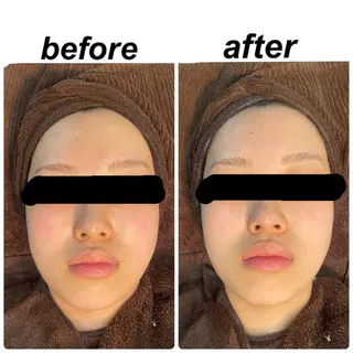 Upm.所属・成島 星哉のエステ・リラクイメージ