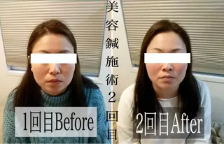 鍼灸 Refineのその他イメージ