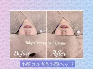 毛穴洗浄& 睫毛パーマ上野御徒町のマツエク・マツパデザイン