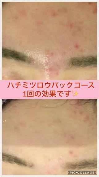 ショート カラー パーマ ヘアアレンジ メンズ キッズ ネイル マツエク・マツパ ニキビ・肌質改善専門 ♡人生が変わるサロンのエステ・リラクイメージ