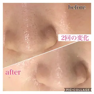 ミディアム カラー パーマ ヘアアレンジ キッズ ネイル マツエク・マツパ EnsorClair 代表 野口真央のエステ・リラクイメージ