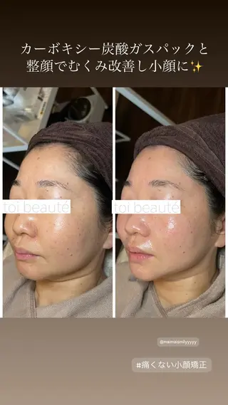 柳瀬 絵美のマツエク・マツパデザイン