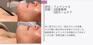 艶肌ワックス ALLY.のエステ・リラクイメージ