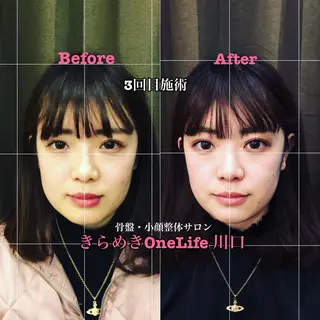 きらめきワンライフ Yumaのエステ・リラクイメージ