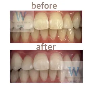 ホワイトニング ショップ船橋店🦷のエステ・リラクイメージ