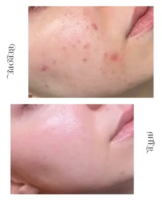 脱毛・肌質改善サロン Linoのエステ・リラクイメージ