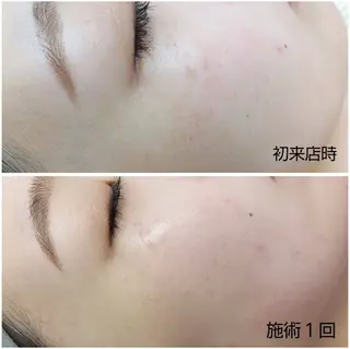 シミケア専門店 HAQUAのエステ・リラクイメージ