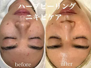 肌管理サロン neoriiのその他イメージ
