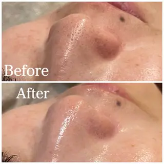 Nna 韓国肌管理のエステ・リラクイメージ