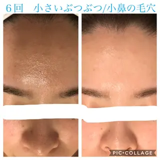 ショート カラー パーマ ヘアアレンジ キッズ ネイル マツエク・マツパ EnsorClair 代表 野口真央のエステ・リラクイメージ