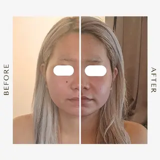 鍼灸サロンmiyabi所属・美容鍼×エステ　鍼灸 サロンmiyabiのエステ・リラクイメージ