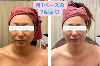 35歳からの エイジングケアサロンのエステ・リラクイメージ