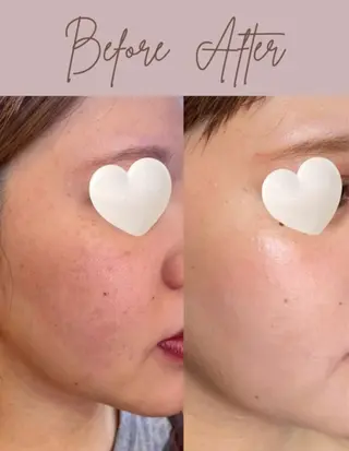 salon merci和泉のエステ・リラクイメージ