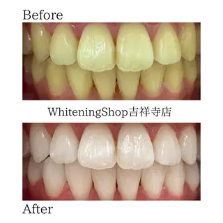 ホワイトニングショッ 吉祥寺2号店のその他イメージ