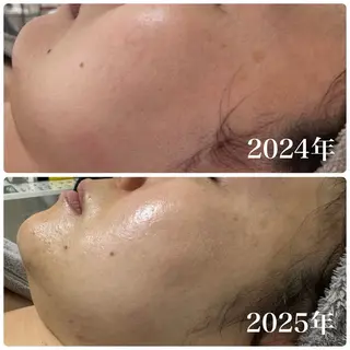 小顔リフトアップ 美肌改善専門店のエステ・リラクイメージ