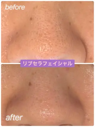 プライベートサロン プリュネルのエステ・リラクイメージ