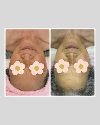 Salon Rion所属・Rion 野々村のエステ・リラクイメージ