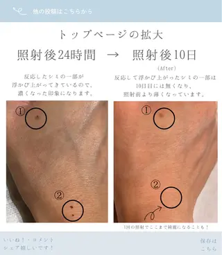 くすみ・シミ改善/ ララピール/光フォトのその他イメージ